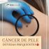 Dúvidas frequentes sobre câncer de pele